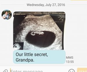 1st_Baby_Pic